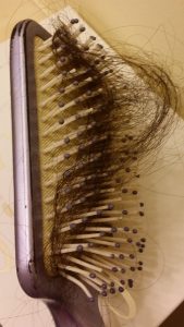 hair loss in brush