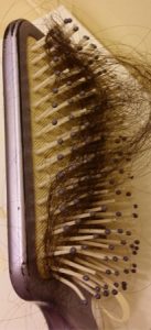 hair loss in brush
